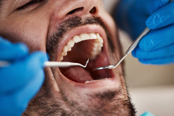 Best Emergency Dental Care for Abscessed Tooth in Hendersonville, NC