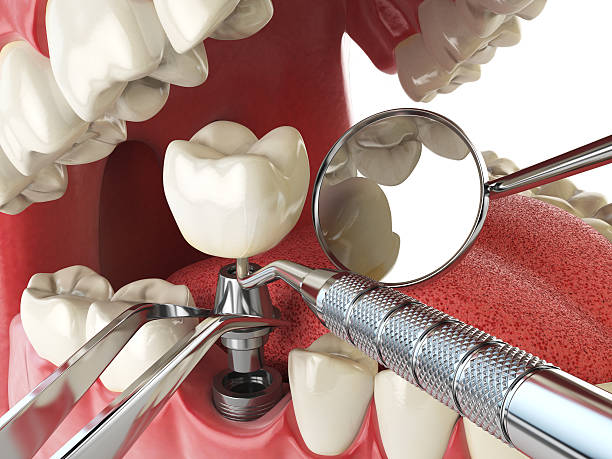 Best Emergency Cosmetic Dentistry in Hendersonville, NC